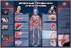 Электрифицированный стенд "Вредные привычки: алкоголизм" - fgospostavki.ru - Челябинск