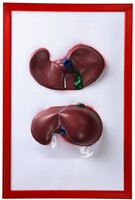 Барельефная модель "Печень" - fgospostavki.ru - Челябинск