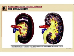 Рельефная таблица "Почка. Фронтальный разрез" (формат А1, матовое ламинирование) - fgospostavki.ru - Челябинск