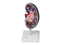 Модель почки в разрезе - fgospostavki.ru - Челябинск