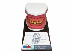 Демонстрационная модель "Ротовая полость курильщика" - fgospostavki.ru - Челябинск
